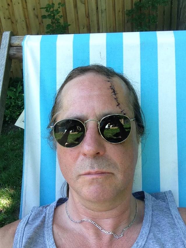 russdwarfheadinjury
